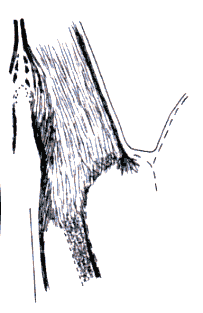 wpe24.gif (8933 bytes)